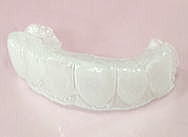 ミュージックスプリント