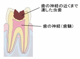 ドックベストセメント１