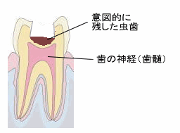 ドックベストセメント２